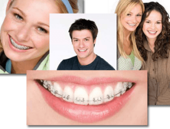 ortodoncia dentistas en Lima ortodoncia dentistas en Lima